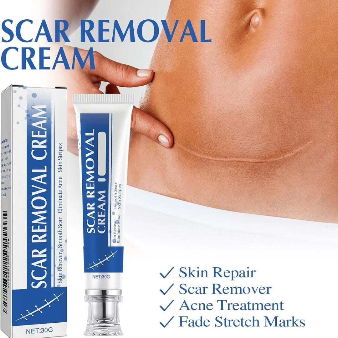 SCAR REMOVAL CREAM PACK OF 1