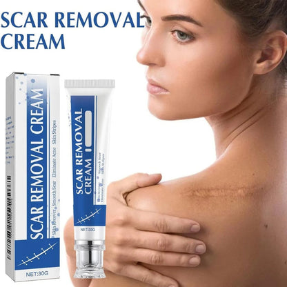 SCAR REMOVAL CREAM PACK OF 1